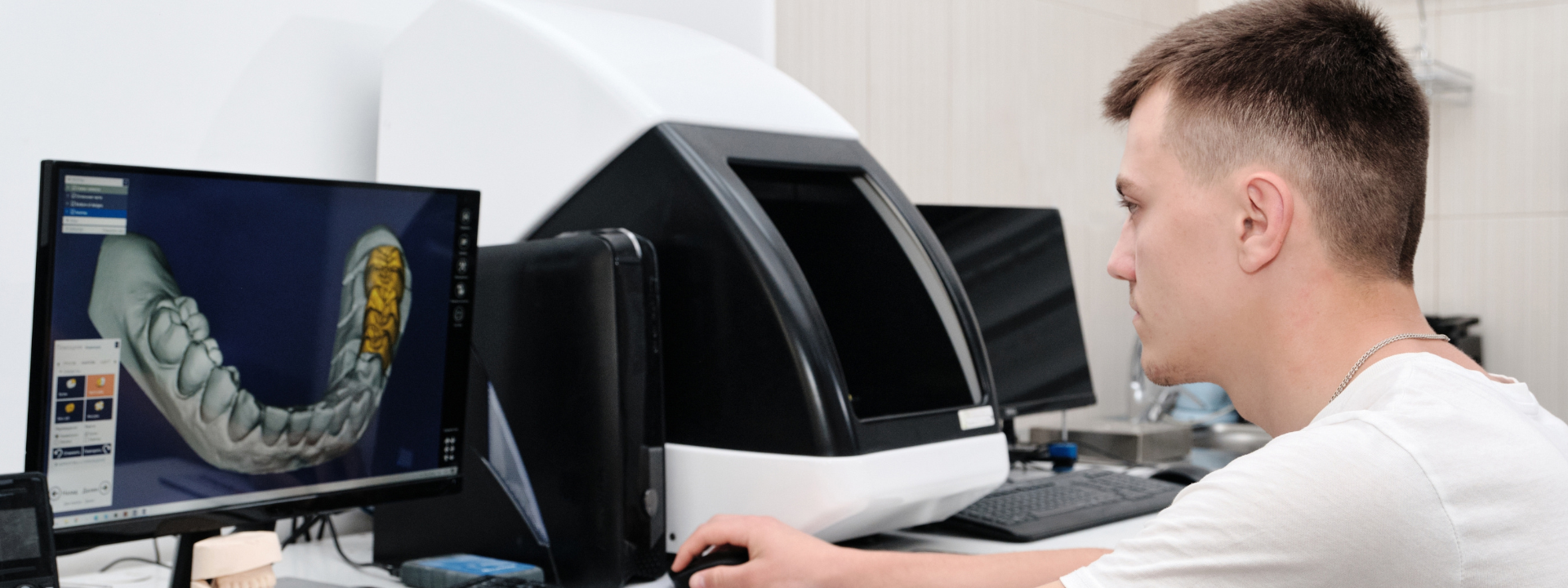 Digital Dentures in Coquitlam, BC