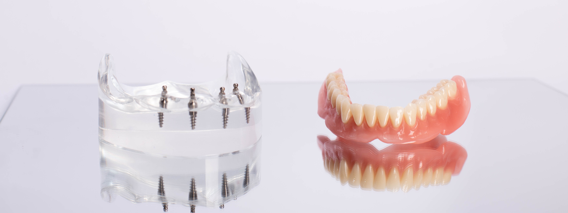All-on-4® Dental Implant Treatment in Coquitlam, BC