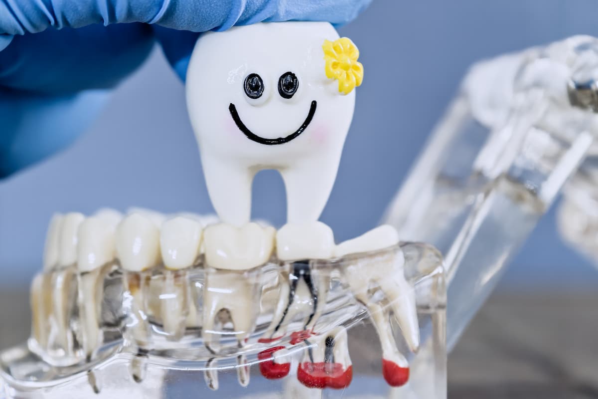 A Better Smile Starts with Dental Implants in Coquitlam