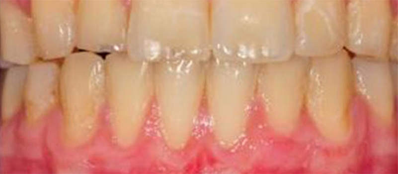 Periodontic2_After.png