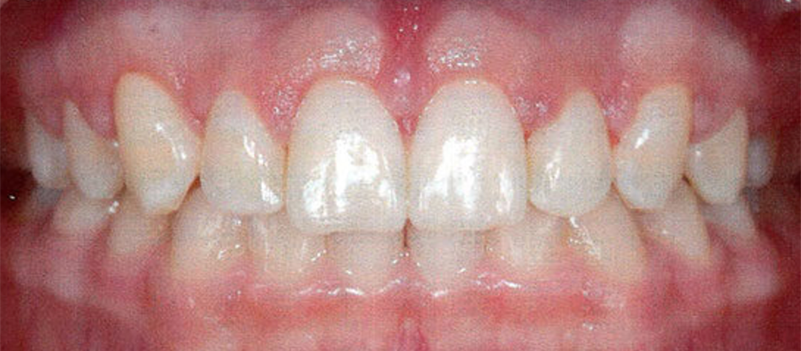 Periodontic7_After.png